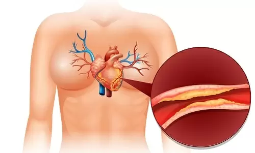 Menopausia y colesterol Menopausia y colesterol