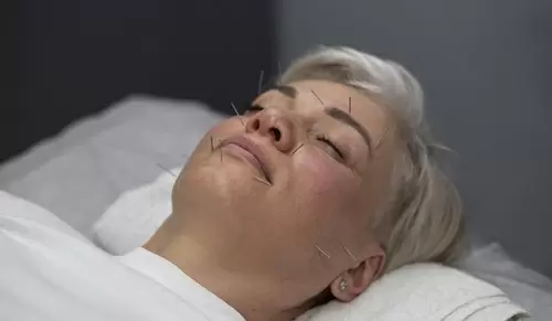 ¿Cómo ayuda la acupuntura en la menopausia? ¿Cómo ayuda la acupuntura en la menopausia?