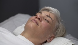 ¿Cómo ayuda la acupuntura en la menopausia?